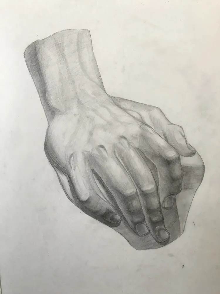 Гипсовая рука