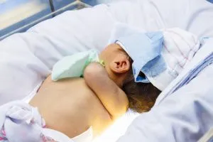 Фототерапия новорожденных при желтухе 
